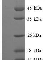 Nosema bombycis Polar tube protein 3 (PTP3), partial Recombinant Protein - BioCrest Sci