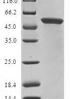 Human Glycine N-acyltransferase-like protein 1 (GLYATL1) Recombinant Protein - BioCrest Sci