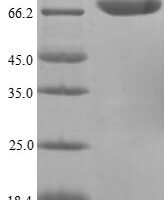 Campylobacter jejuni Flagellin A (flaA), partial Recombinant Protein - BioCrest Sci