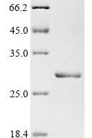 Rat Interleukin-11 (Il11) Recombinant Protein, N-His-PDI - BioCrest Sci