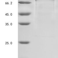 Human Dipeptidyl peptidase 4 (DPP4), partial Recombinant Protein, N-His - BioCrest Sci