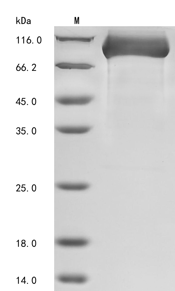 Human Dipeptidyl peptidase 4 (DPP4), partial Recombinant Protein, N-His, Homo sapiens (Human), Yeast, N-terminal 6xHis-tagged, 87.4 kDa, purity >≥ 90% as determined by SDS-PAGE.