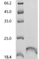 Human MHC class I polypeptide-related sequence B (MICB), partial Recombinant Protein, N-His, aa 204–297 - BioCrest Sci