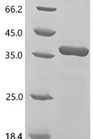 Human Anthrax toxin receptor 2 (ANTXR2), partial Recombinant Protein - BioCrest Sci