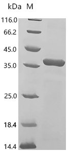 Human Anthrax toxin receptor 2 (ANTXR2), partial Recombinant Protein, Homo sapiens (Human), E.coli, C-terminal 6xHis-tagged, 37.6 kDa, purity >≥ 95% as determined by SDS-PAGE.