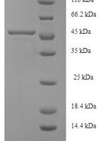 Human Serine--pyruvate aminotransferase (AGXT) Recombinant Protein, N-His, aa 1–392, E.coli - BioCrest Sci