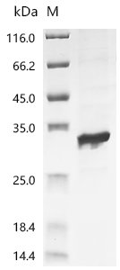 Escherichia phage T7 T7 RNA polymerase (1), partial Recombinant Protein, Escherichia phage T7 (Bacteriophage T7), E.coli, N-terminal 6xHis-SUMO-tagged, 40.1 kDa, purity >≥ 90% as determined by SDS-PAGE.