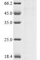 Vaccinia virus Envelope protein H3 (OPG108) (X27S,X28S,X29S), partial Recombinant Protein, C-His - BioCrest Sci