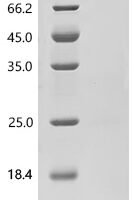 N-terminal 6xHis-NEXT-tagged Recombinant Protein - BioCrest Sci