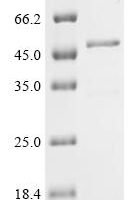 Bovine Troponin T, slow skeletal muscle (TNNT1) Recombinant Protein - BioCrest Sci