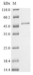 Bovine Troponin T, slow skeletal muscle (TNNT1) Recombinant Protein, Bos taurus (Bovine), E.coli, N-terminal 10xHis-tagged and C-terminal Myc-tagged, 38.7 kDa, purity >≥ 85% as determined by SDS-PAGE.