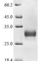 Mouse Collagen triple helix repeat-containing protein 1 (Cthrc1) Recombinant Protein, C-10His - BioCrest Sci