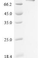Epstein-Barr virus envelope glycoprotein GP350 (BLLF1), partial Recombinant Protein, C-10His - BioCrest Sci