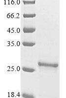 Thermus thermophilus Ribonuclease HII (rnhB) Recombinant Protein - BioCrest Sci