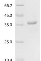 Human Glyceraldehyde-3-phosphate dehydrogenase (GAPDH) Recombinant Protein, C-10His - BioCrest Sci