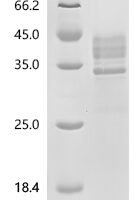 Human Tumor necrosis factor receptor superfamily member 13C (TNFRSF13C), partial Recombinant Protein, C-hFc1, aa 2–26 & E & 27–28 & 30–71 (H31S), Purity ≥90% - BioCrest Sci
