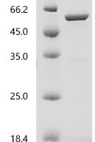 avian paramyxovirus 4 Nucleocapsid (NP) Recombinant Protein, N-10His/C-Myc - BioCrest Sci