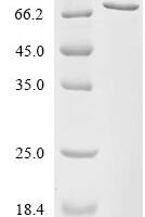 Enterobacteria phage T4 Large terminase protein (17) Recombinant Protein - BioCrest Sci