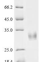 Cat Fibroblast growth factor 23 (FGF23)(R174Q) Recombinant Protein - BioCrest Sci
