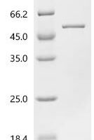 Escherichia coli Queuine tRNA-ribosyltransferase (tgt) Recombinant Protein - BioCrest Sci