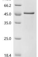 Human Protein Wnt-3a (WNT3A), partial Recombinant Protein, C-10His - BioCrest Sci