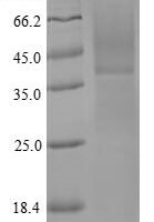 Tachypleus tridentatus clotting factor C, partial Recombinant Protein, N-His, aa 763–1019, Yeast - BioCrest Sci