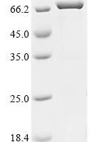 Human Acetylcholine receptor subunit alpha (CHRNA1), partial, Biotinylated Recombinant Protein - BioCrest Sci