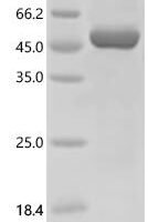 Human Arf-GAP with dual PH domain-containing protein 1 (ADAP1) Recombinant Protein, C-His - BioCrest Sci