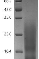 Cat Major allergen I polypeptide chain 2 (CH2) Recombinant Protein, C-His, aa 18–109, Felis catus (Cat) (Felis silvestris catus) - BioCrest Sci