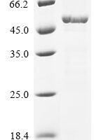 Escherichia coli Cell shape-determining protein MreB (mreB) Recombinant Protein - BioCrest Sci