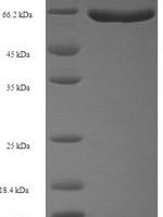 Schizosaccharomyces pombe Sulfide:quinone oxidoreductase, mitochondrial (hmt2) Recombinant Protein, N-His-SUMO - BioCrest Sci