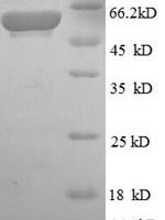 Escherichia coli Aerobic glycerol-3-phosphate dehydrogenase (glpD) Recombinant Protein, N-His, aa 1–501, E.coli - BioCrest Sci