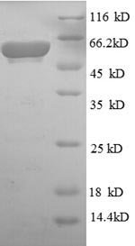 Escherichia coli Aerobic glycerol-3-phosphate dehydrogenase (glpD) Recombinant Protein, N-His, aa 1–501, E.coli, Escherichia coli (strain K12), E.coli, N-terminal 6xHis-tagged, 60.8 kDa, purity >≥ 90% as determined by SDS-PAGE.