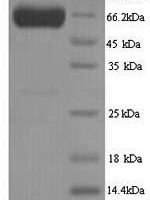 Human Pyruvate kinase PKLR (PKLR) Recombinant Protein - BioCrest Sci