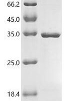Human cytomegalovirus Viral transcription factor IE2 (UL122), partial Recombinant Protein - BioCrest Sci