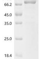 Human G1/S-specific cyclin-D2 (CCND2), Biotinylated Recombinant Protein - BioCrest Sci