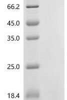 Glycine max Protein kinase domain-containing protein (100788119), partial Recombinant Protein - BioCrest Sci