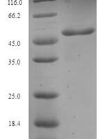 Aspergillus fumigatus Major allergen Asp f 2 Recombinant Protein - BioCrest Sci