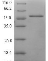 Human Methionine-R-sulfoxide reductase B3 (MSRB3) Recombinant Protein - BioCrest Sci