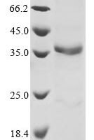 Mouse ADAM DEC1 (Adamdec1) Recombinant Protein - BioCrest Sci