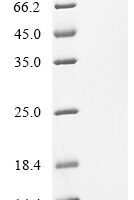 Human C-X-C chemokine receptor type 5 (CXCR5), partial Recombinant Protein - BioCrest Sci