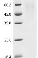 Feline herpesvirus 1 Envelope glycoprotein D (US6), partial Recombinant Protein, N-His - BioCrest Sci