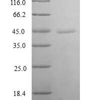Human Thioredoxin-like protein 4B (TXNL4B) Recombinant Protein - BioCrest Sci
