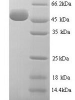 Human Hyaluronidase-1 (HYAL1) Recombinant Protein, N-His, aa 22–435, Yeast - BioCrest Sci