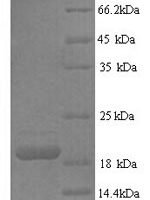 Human Tumor necrosis factor ligand superfamily member 6 (FASLG), partial Recombinant Protein, N-His, aa 130–281, Yeast - BioCrest Sci