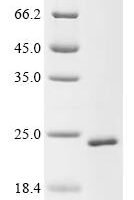 Mouse Sorting nexin-32 (Snx32), partial Recombinant Protein, Tag-Free, aa 1–180 - BioCrest Sci