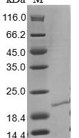 Human Ribonuclease 4 (RNASE4) Recombinant Protein, N-10His/C-Myc - BioCrest Sci