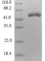 Human Nuclear inhibitor of protein phosphatase 1 (PPP1R8) Recombinant Protein - BioCrest Sci