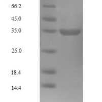 Human Cyclin-dependent kinase4 (CDK4) Recombinant Protein - BioCrest Sci