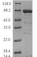 Human Modulator of apoptosis 1 (MOAP1) Recombinant Protein - BioCrest Sci